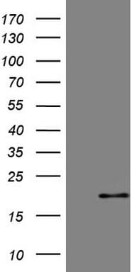 p16INK4a / CDKN2A Antibody (clone OTI4E9)