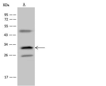 Polyclonal Rabbit anti-Human TMEM192 Antibody (IHC, IF, WB)