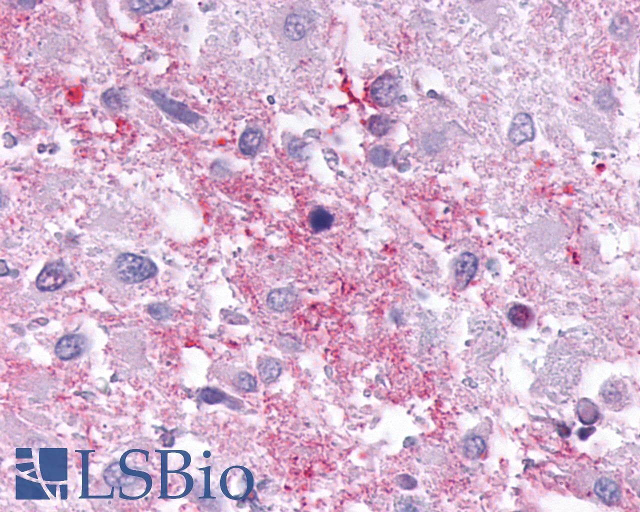 PathPlus™ Polyclonal Rabbit anti-Human CNR1 / CB1 Antibody (C-Terminus, IHC)
