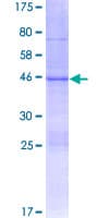 Human AXIN2 / Axin 2 Protein (Recombinant GST)