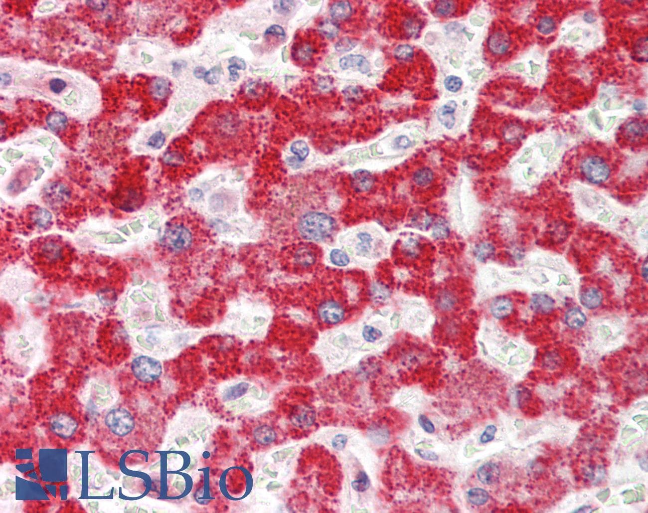 IVD Antibody (aa62-111)