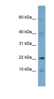 Polyclonal Rabbit anti-Human DPPA5 Antibody (N-Terminus, WB)