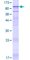 Human TMC4 Protein (Recombinant GST)