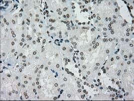 Monoclonal Mouse anti-Human PMEL / SILV / gp100 Antibody (clone OTI10E5, IHC, IF, WB)