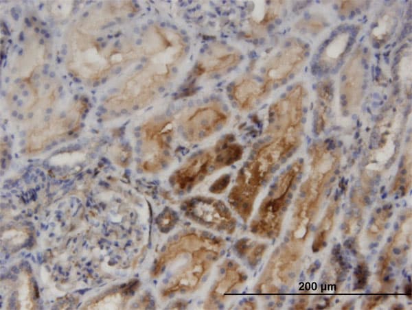 Monoclonal Mouse anti-Human PACSIN2 Antibody (clone 3D6, IHC, WB)