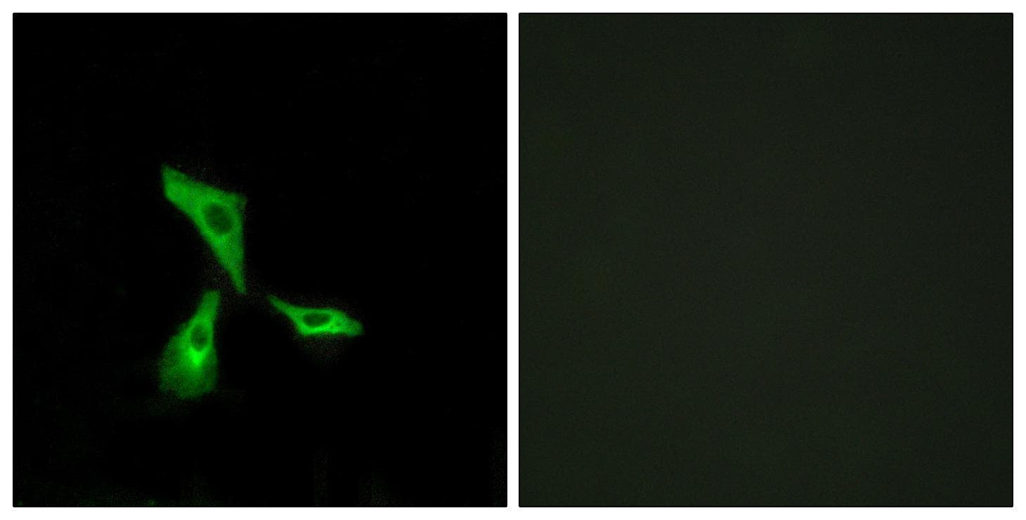 Polyclonal Rabbit anti-Human GPCR6 / GPR101 Antibody (IF, WB)