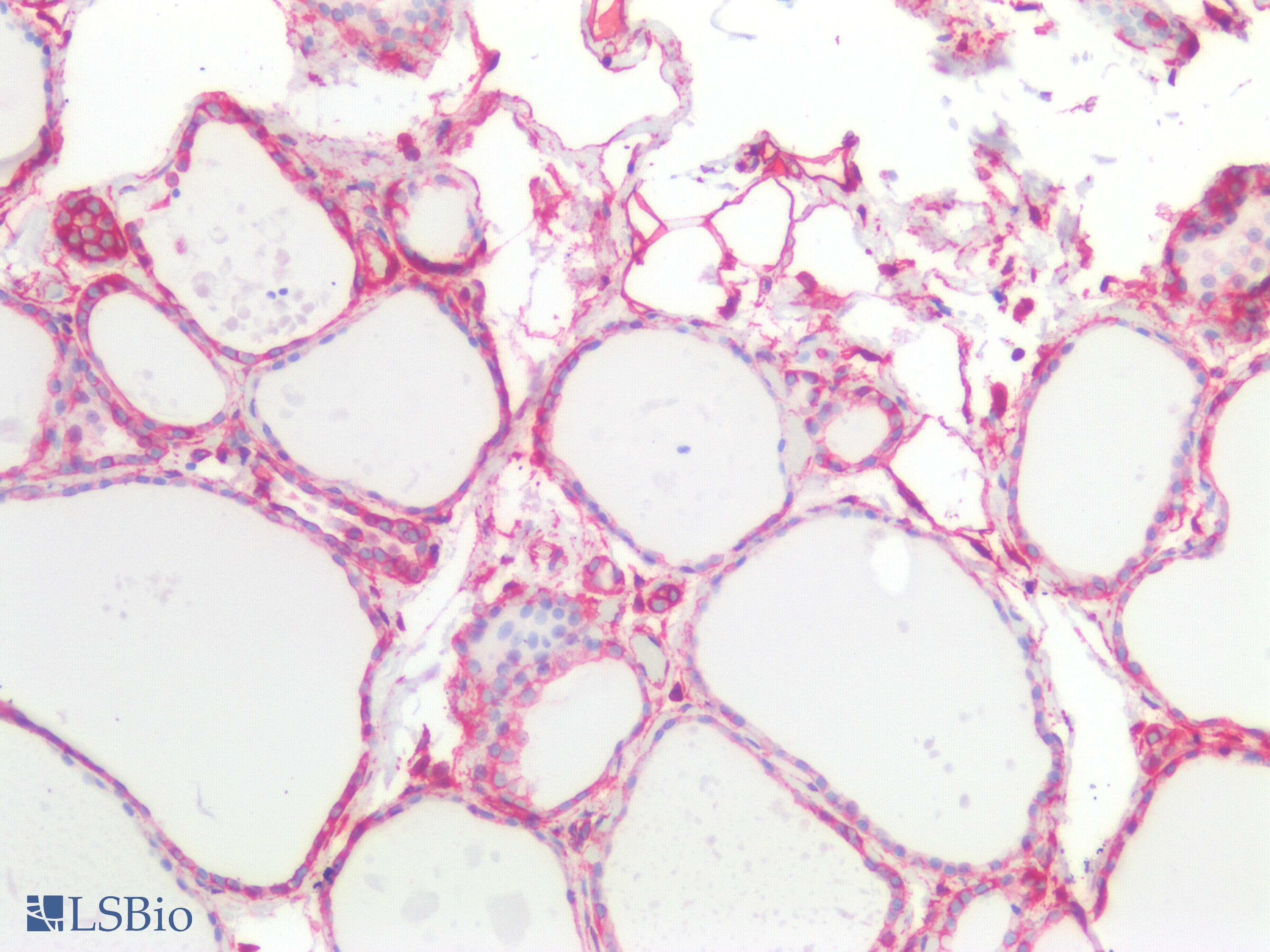 PathPlus™ Polyclonal Rabbit anti-Human Vimentin Antibody (IHC)