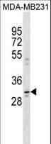 Polyclonal Rabbit anti-Human CCDC28A Antibody (aa79-107, WB)
