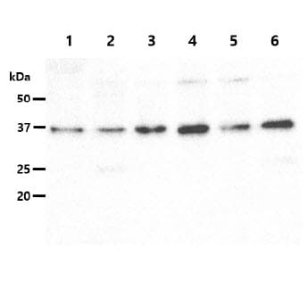 GALE / UDP-Glucose 4-Epimerase Antibody (clone AT6G10)