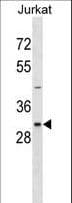 IHC-plus™ NEK7 Antibody (aa1-30)
