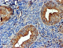 TUBAL3 Antibody (clone OTI5E4)