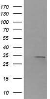 RARRES1 Antibody (clone OTI1B3)