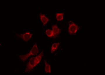 SUMO1 / SMT3 Antibody