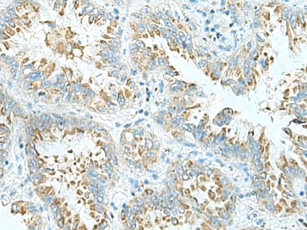 SHOOTIN1 / KIAA1598 Antibody