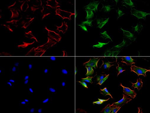 KRT8 / CK8 / Cytokeratin 8 Antibody (aa91-381, clone UMAB1)