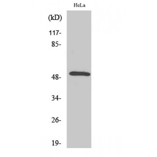 SCTR / SR / Secretin Receptor Antibody (70-150 aa, Internal)