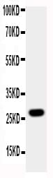 Polyclonal Rabbit anti-Human AQP8 / Aquaporin 8 Antibody (aa1-19, WB)