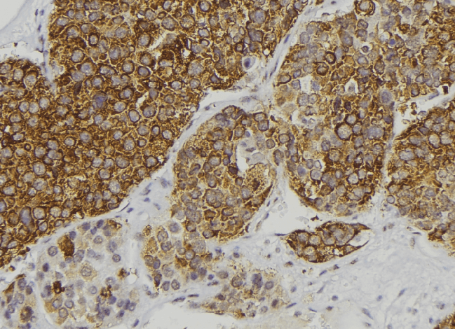 REN / Renin 1 Antibody