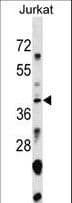 SNAPC1 Antibody (aa139-168)