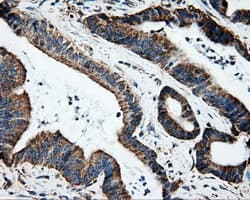 Heat Shock Protein 70 / HSPA1A Antibody (clone OTI1B2)