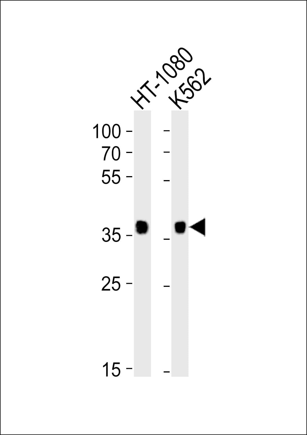 MRGPRX3 / MRGX3 Antibody (aa9-43)