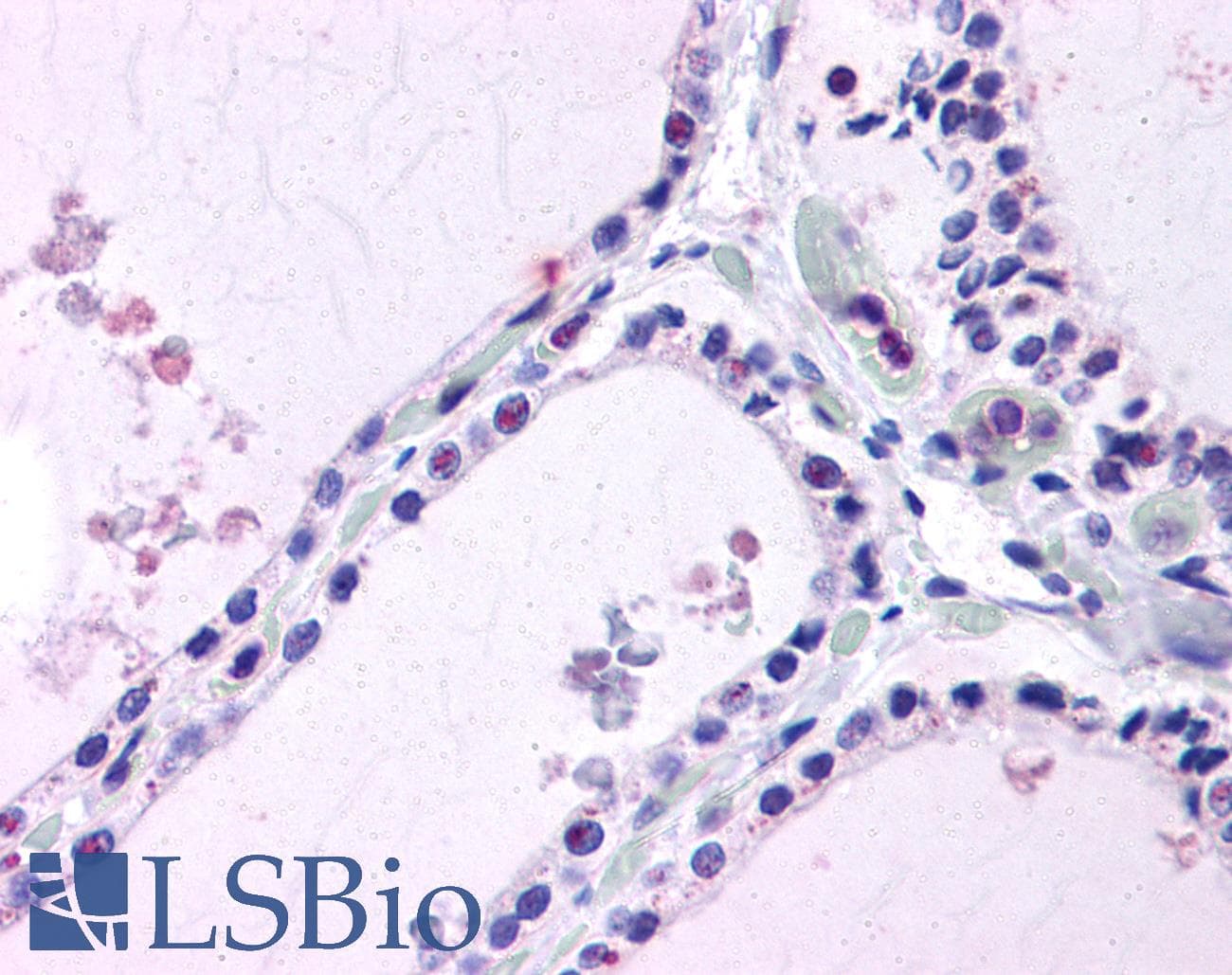 IHC-plus™ Polyclonal Rabbit anti-Human LPCAT1 / AYTL2 Antibody (Internal, IHC)