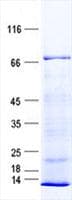 Human HAL / Histidine Ammonium Lyase Protein (Recombinant His, N-Terminal)