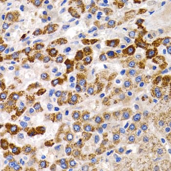 CYP24 / CYP24A1 Antibody
