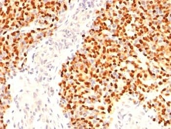 MYOG / Myogenin Antibody (aa138-158, clone F5D, Ready-to-Use)