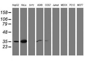 Monoclonal Mouse anti-Human CNN2 Antibody (clone OTI2B5, IHC, IF, WB)
