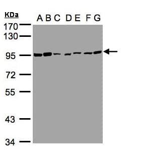 CEACAM5 / CD66e Antibody (aa395-702)