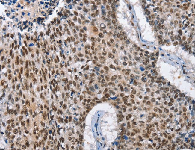 GNRH Antibody