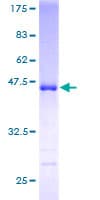 Human NUDT3 Protein (Recombinant GST)