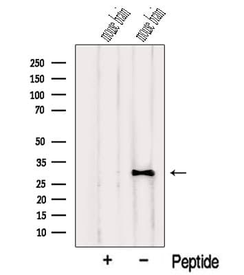 Polyclonal Rabbit anti-Human NUS1 Antibody (WB)