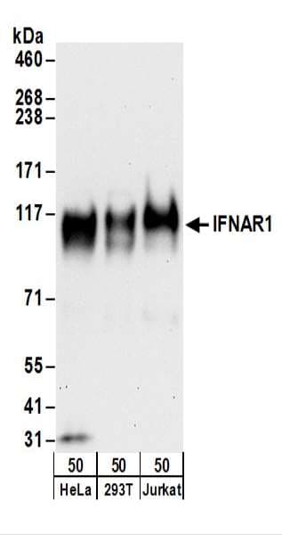 IFNAR1 / IFNAR Antibody (aa507-557)