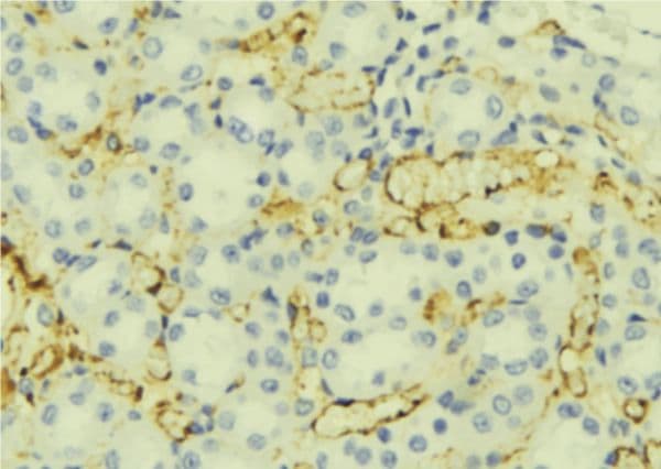 Polyclonal Rabbit anti-Human ORM1 / Orosomucoid Antibody (aa127-149, IHC, WB)