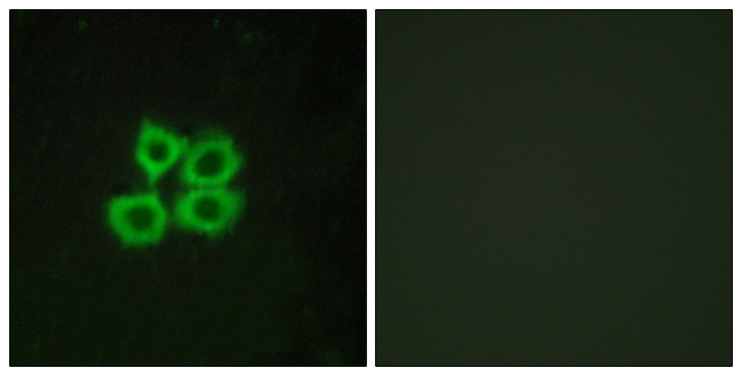 IHC-plus™ CRHR2 / CRF2 Receptor Antibody (aa71-120)