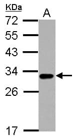 IHC-plus™ TNFRSF14 / CD270 / HVEM Antibody