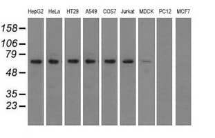 IGF2BP2 Antibody (clone OTI3G7)
