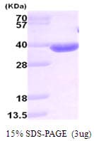 Human AKR1B10 Protein (Recombinant)