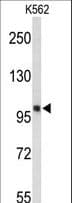HSPH1 / HSP105 Antibody (aa549-579)