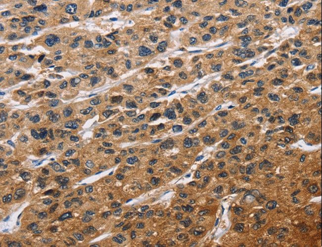 4E-BP2 / EIF4EBP2 Antibody