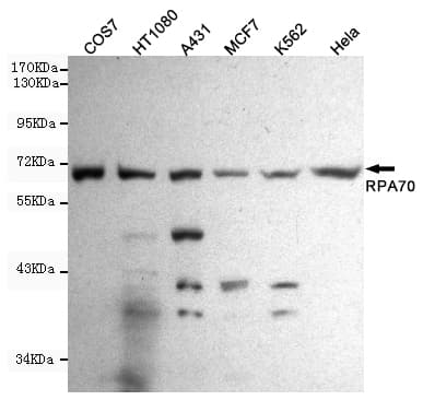 RPA70 / RPA1 Antibody