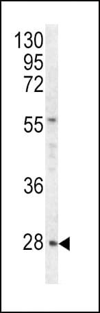 Polyclonal Rabbit anti-Human HPRT1 / HPRT Antibody (aa150-178, IHC, WB)