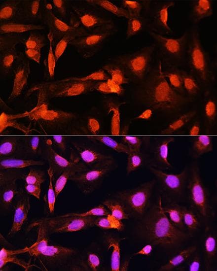 SGOL1 / Shugoshin Antibody