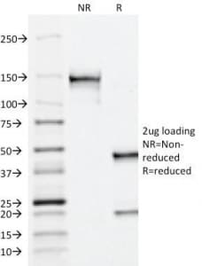 Monoclonal Mouse anti-Human ACPP / PAP Antibody (clone ACCP/1338, Azide-free,BSA-free, IHC, IF)