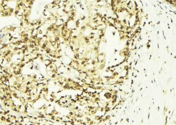 SSNA1 Antibody