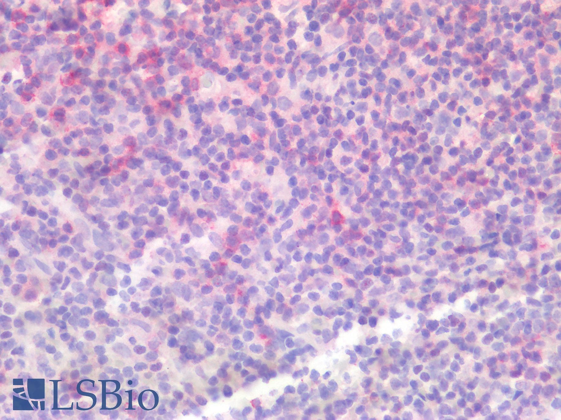 PathPlus™ Monoclonal Mouse anti-Human PDCD1 / CD279 / PD-1 Antibody (clone 5D3, IHC, IF)