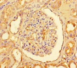 CPT1A Antibody