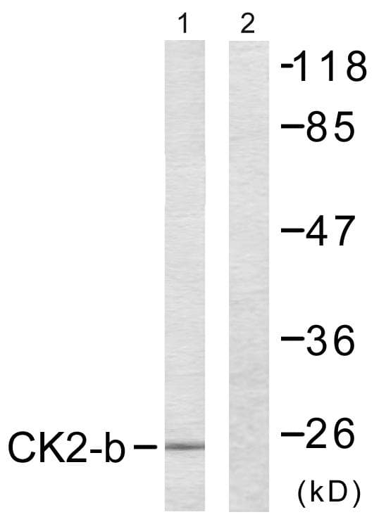 CSNK2B / Phosvitin Antibody (p209)